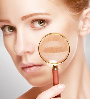 لک های پوستی و روش های درمان
