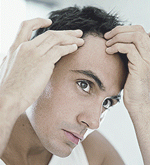 علل ریزش مو در مردان و آقایان